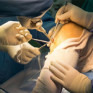 Ortho Surgery Franchise